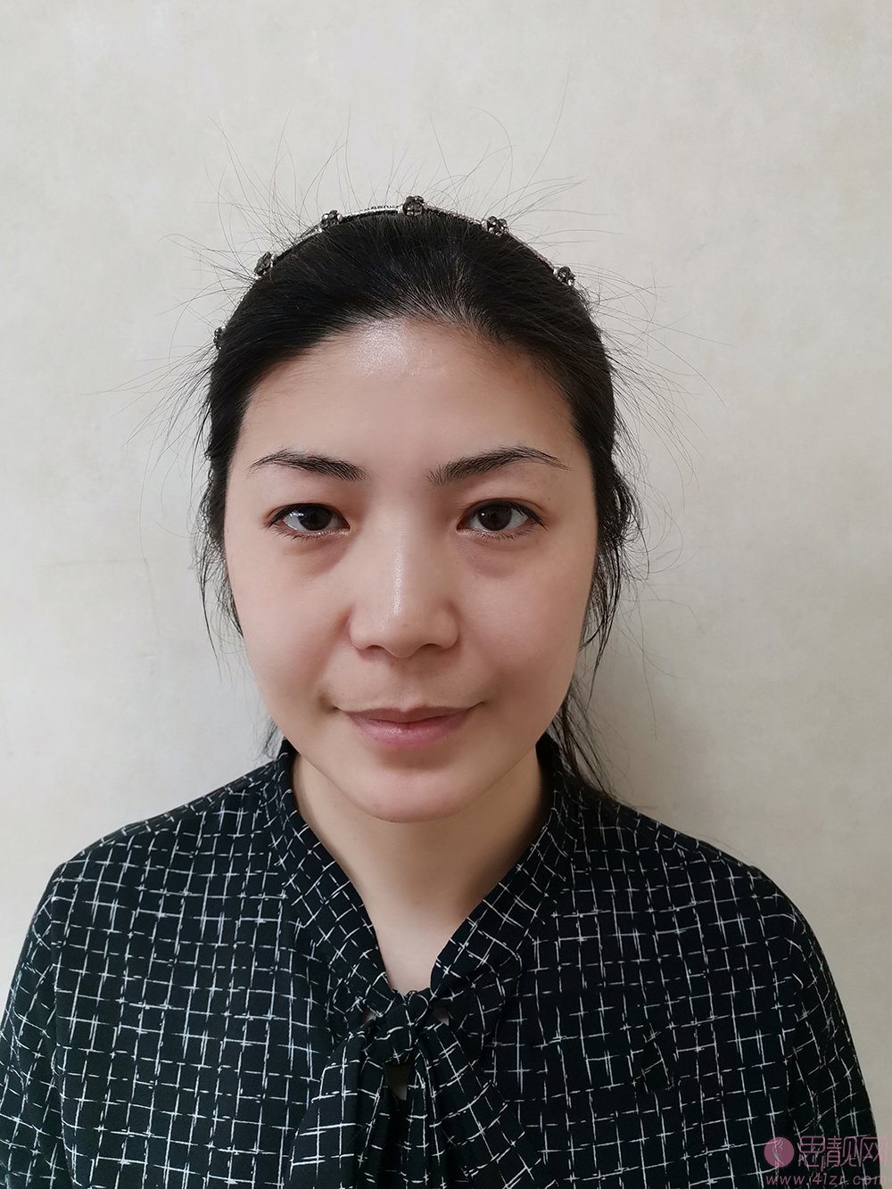 徐州华美整形医院靠谱吗？附医院价格