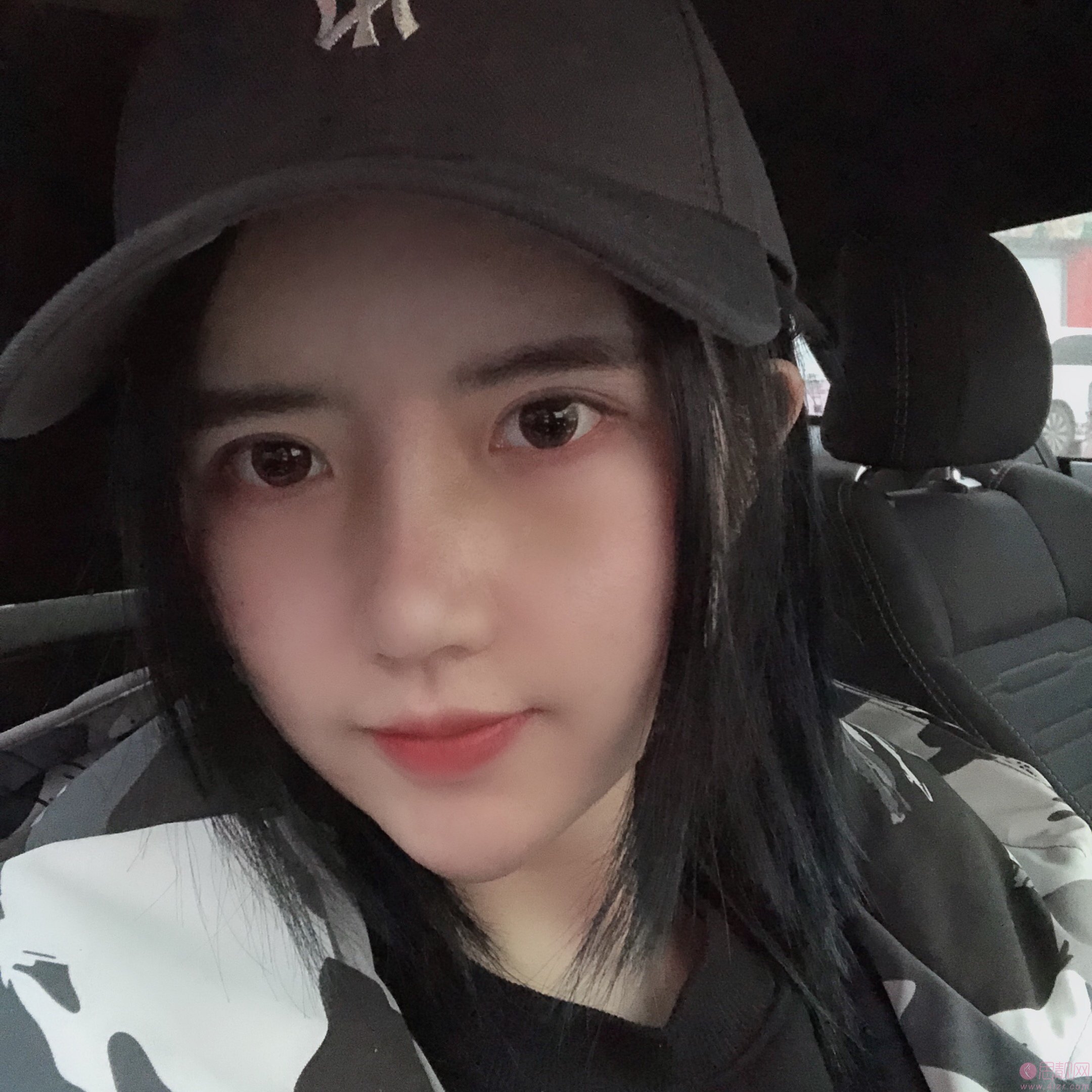 北京世熙整形医院丁砚江做鼻子怎么样，附隆鼻案例一览
