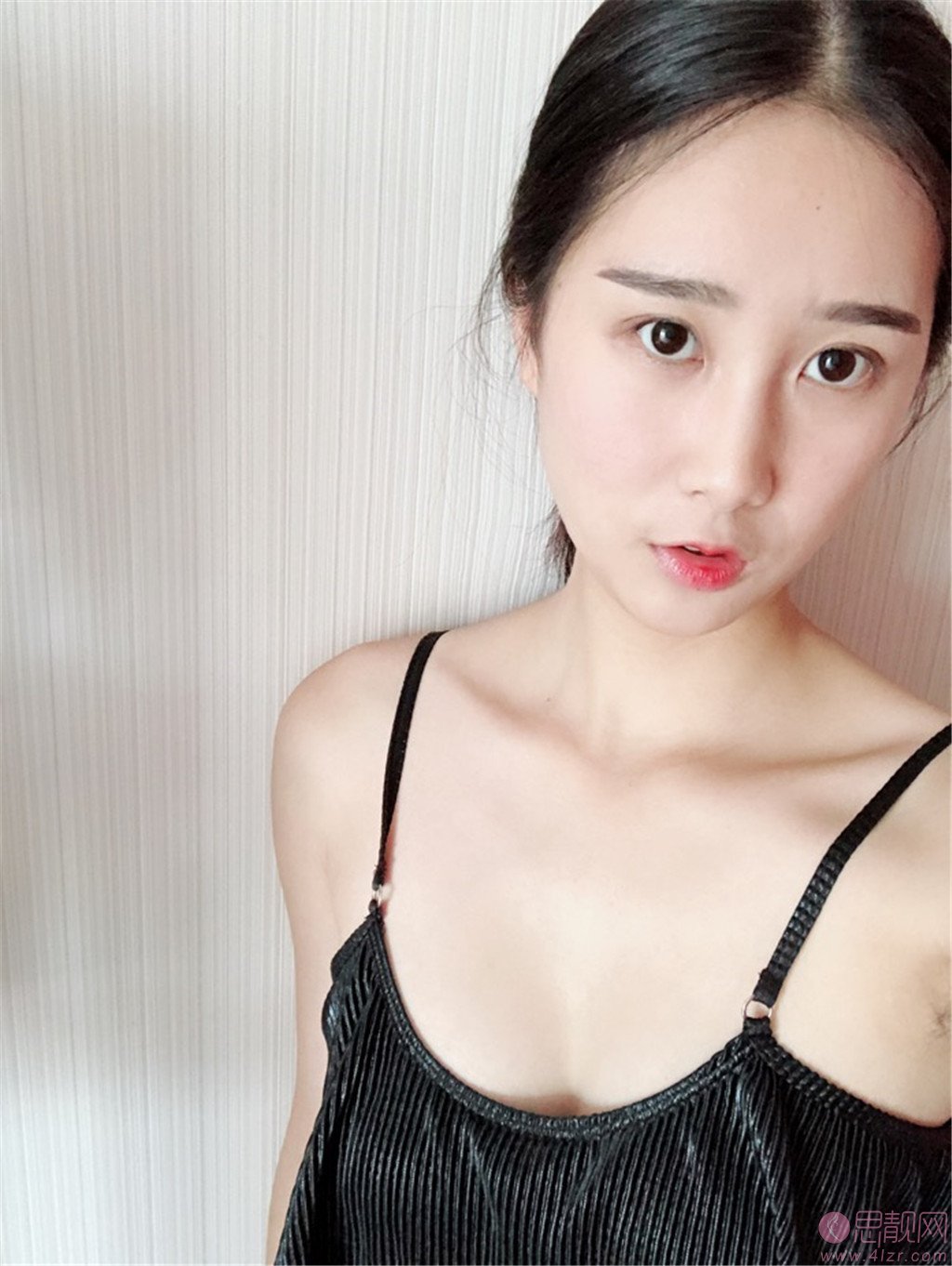 新疆乌鲁木齐黎美医疗美容整形许黎做自体脂肪隆胸怎么样，附案例及价格表