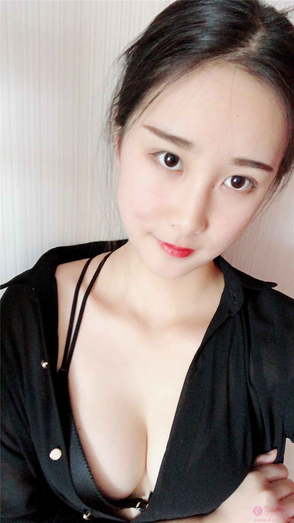 新疆乌鲁木齐黎美医疗美容整形许黎做自体脂肪隆胸怎么样，附案例及价格表