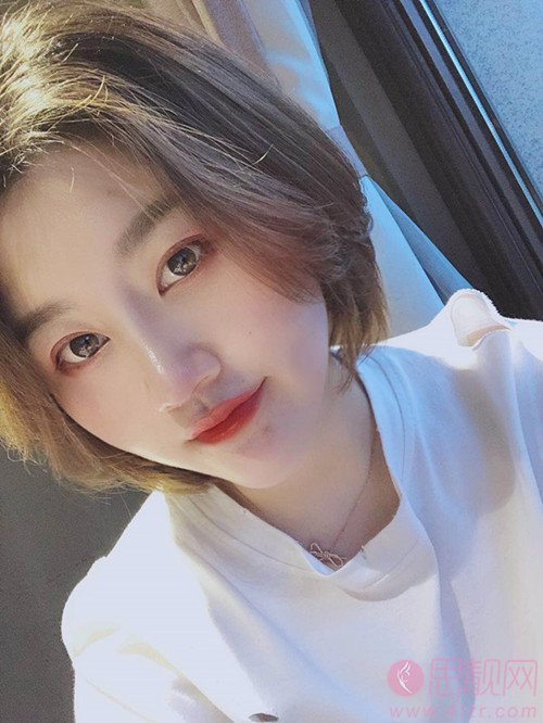 无锡苏亚医疗美容医院吕纲技术怎么样，附隆鼻案例及价格表