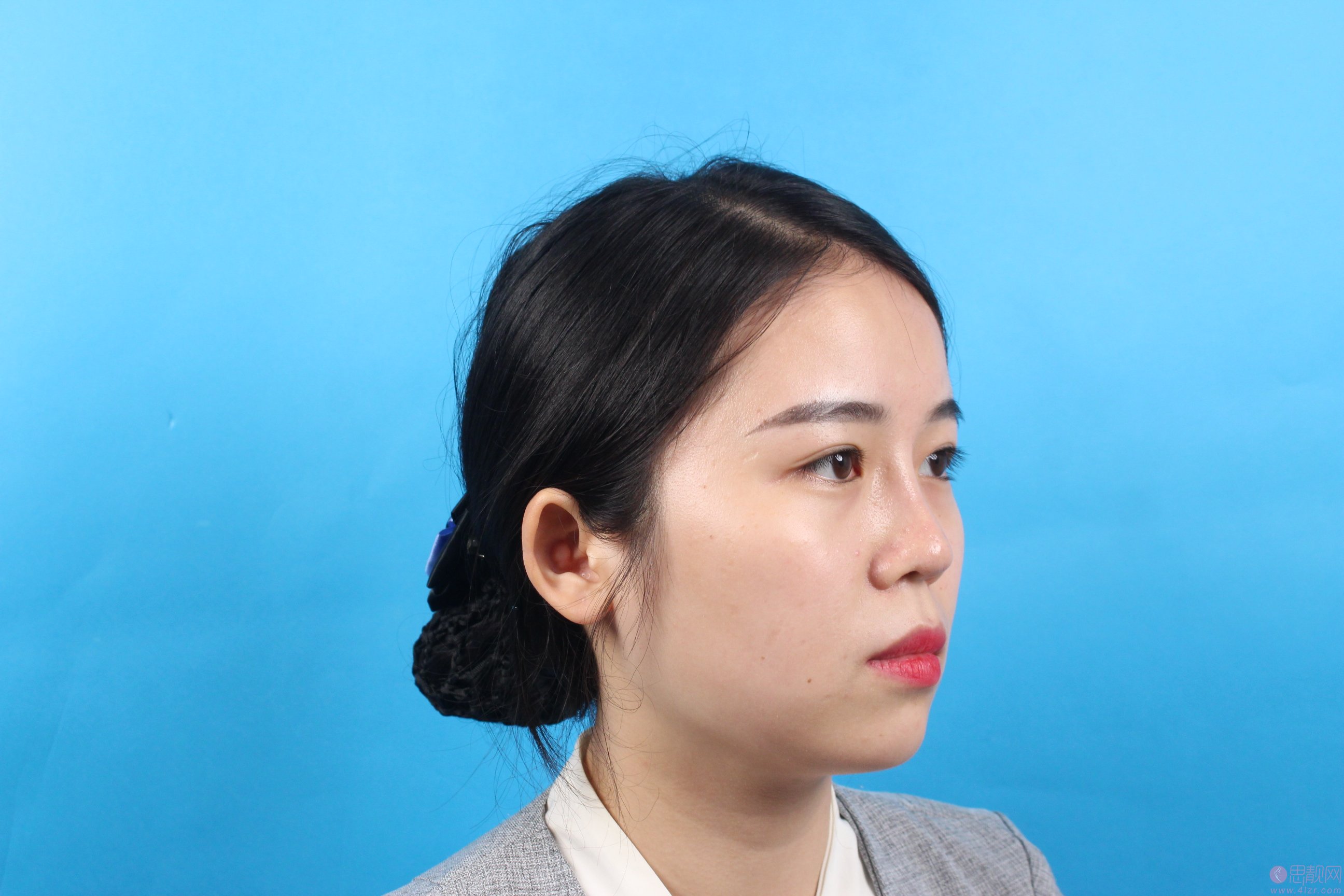 长沙美莱整形倪胜德医生怎么样，附医生案例及价格表