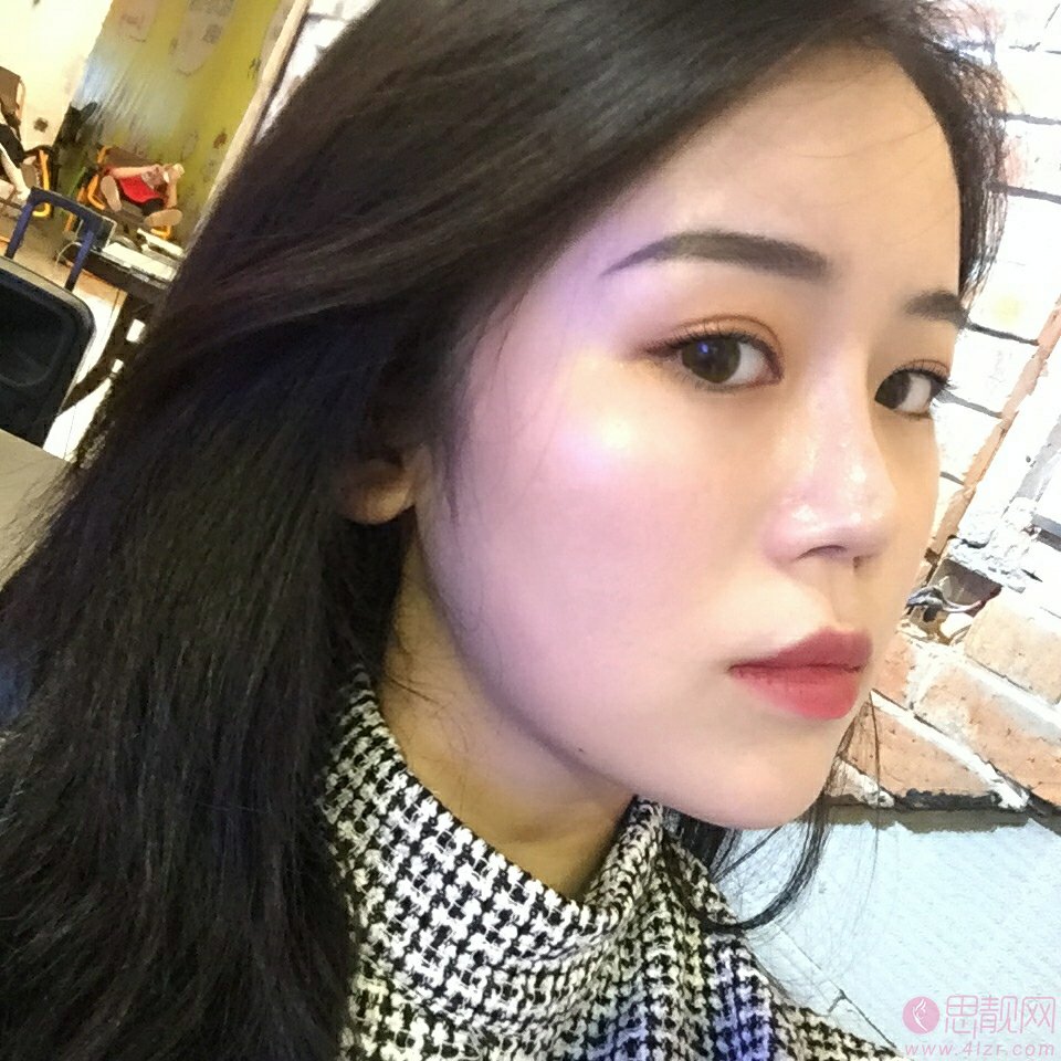 长沙美莱整形倪胜德医生怎么样，附医生案例及价格表