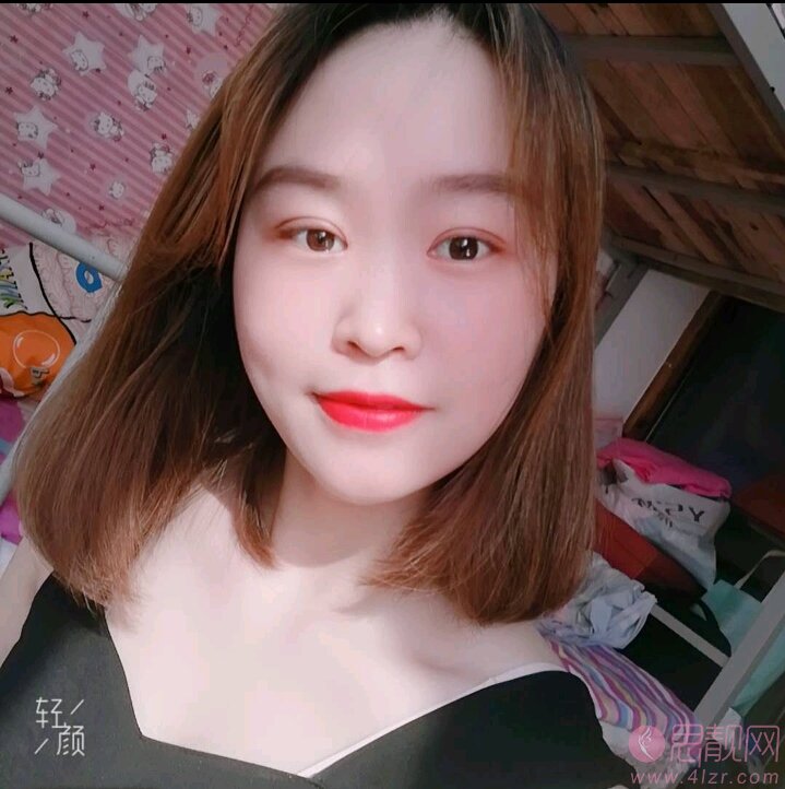 武汉美仑医疗美容陈远海个人简介，附双眼皮案例及价格表公布