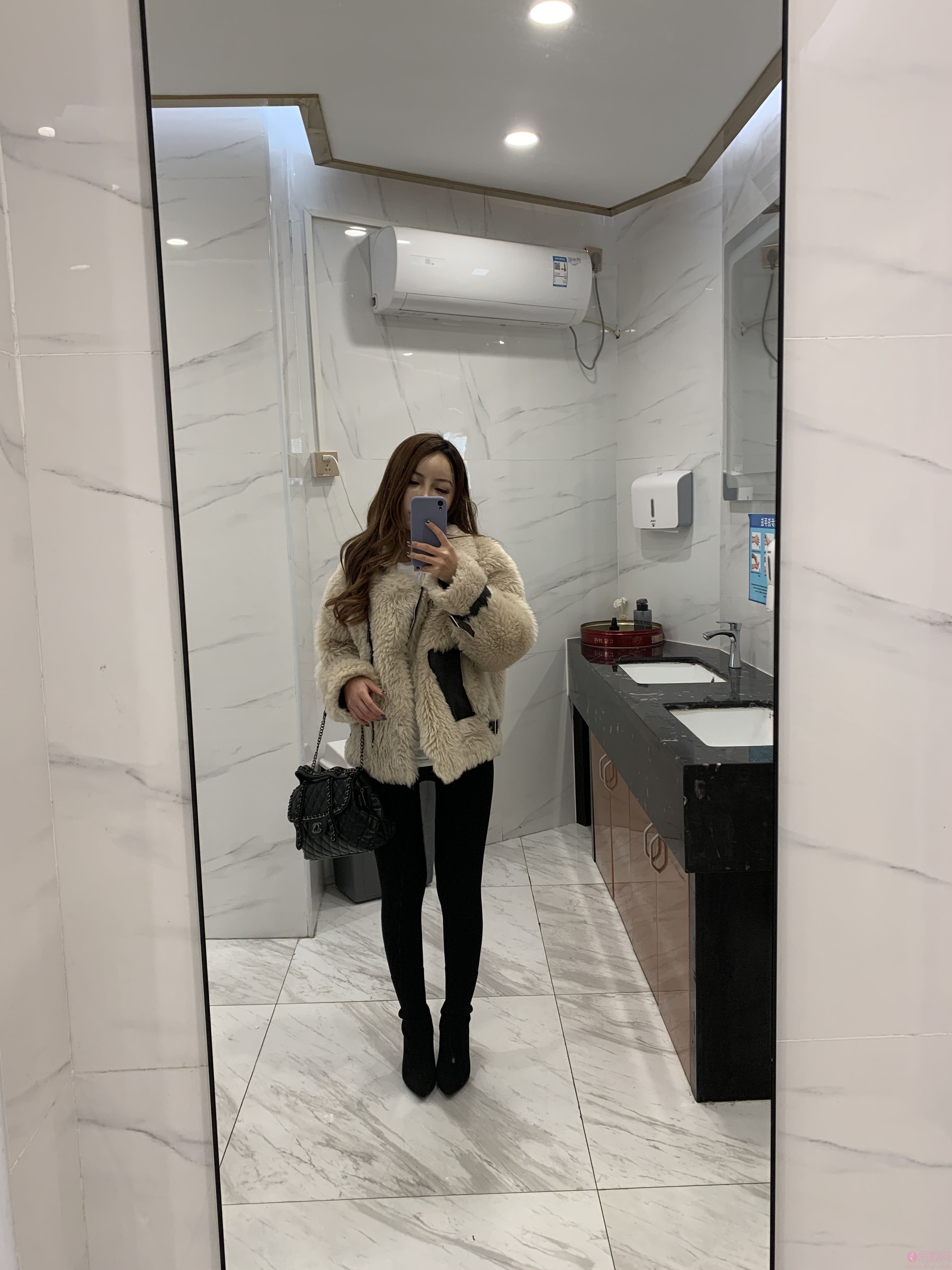 深圳颜美医疗美容门诊部翟万性做吸脂怎么样，附吸脂案例
