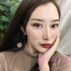 北京明德医院(美容皮肤科)王洪宇医生技术怎么样?附案例一览