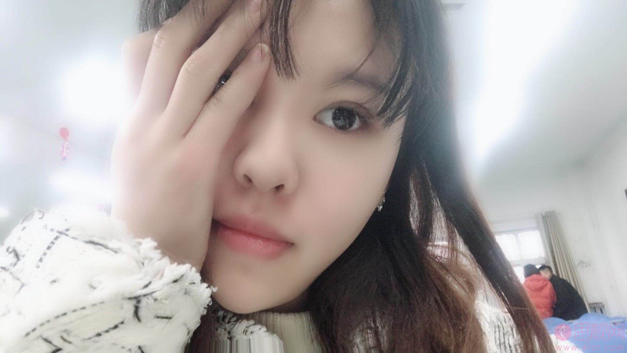济南吉芙医疗美容解学江医生怎么样？附真人隆鼻案例
