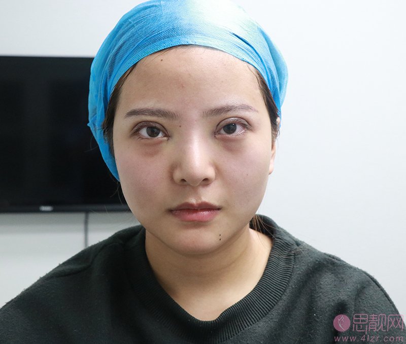 东莞南城知美医疗美容门诊部怎么样？附医院简介及罗广杰医生案例