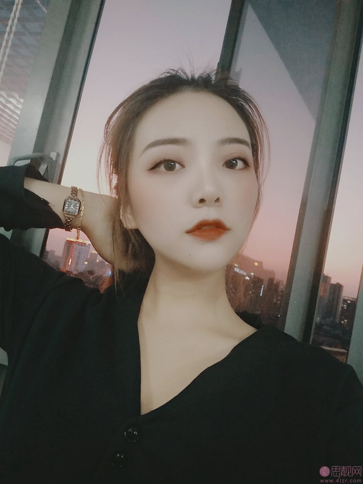 东莞南城知美医疗美容门诊部怎么样？附医院简介及罗广杰医生案例