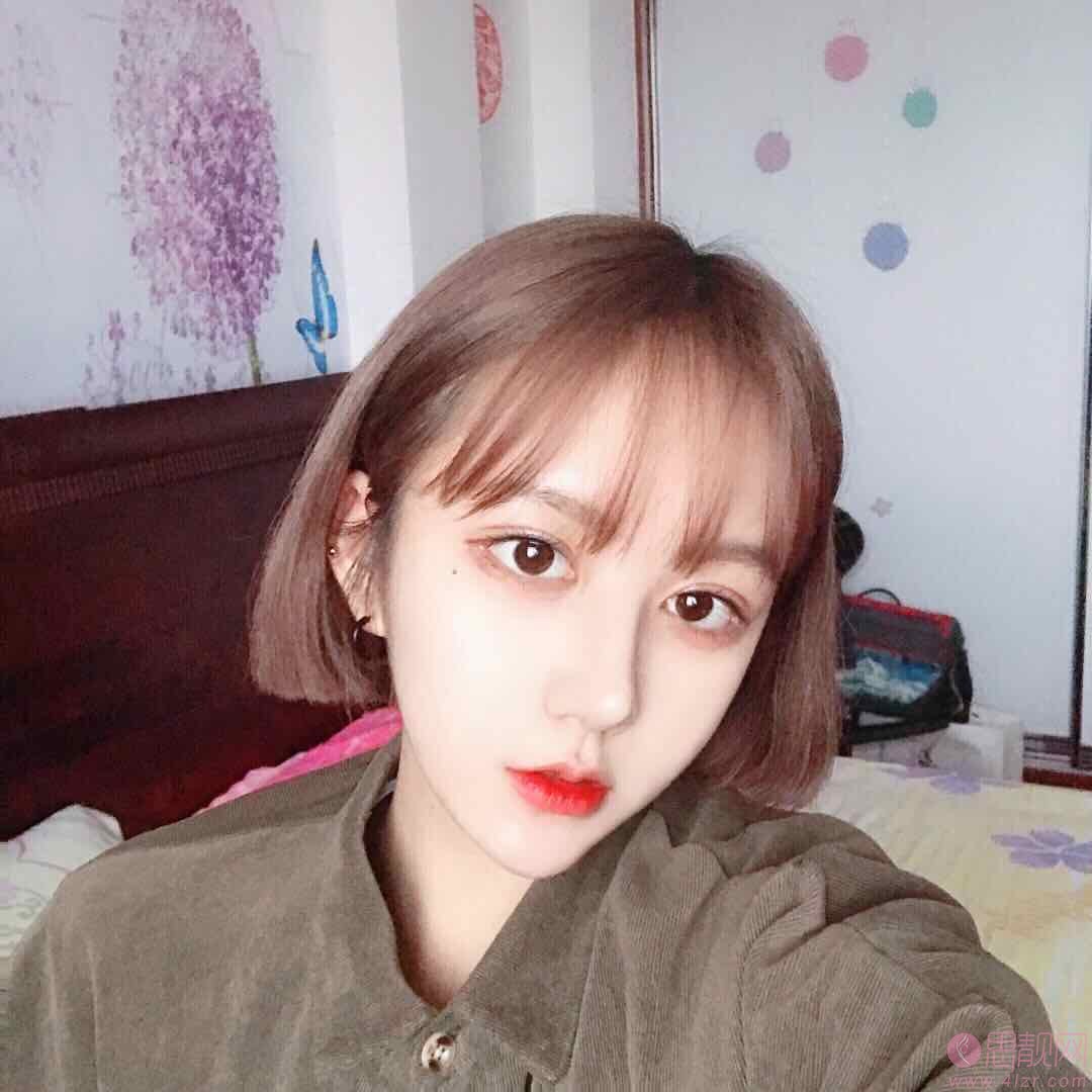 温州芘丽芙美容医院金锋医生做鼻子怎么样？附隆鼻真人案例