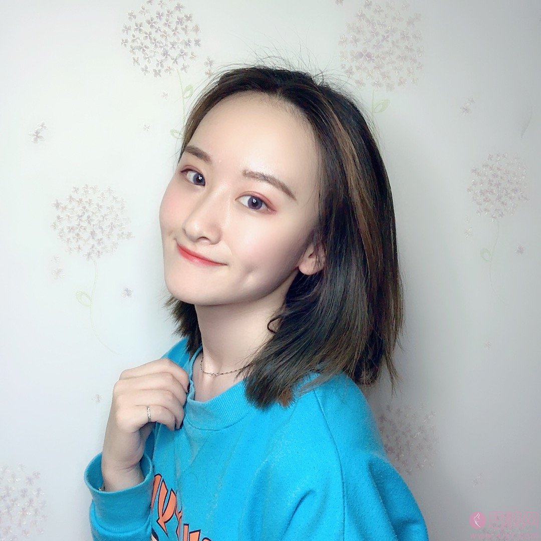 杭州薇琳医疗美容医院怎么样？附张霞飞医生双眼皮案例