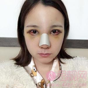 上海天大医疗美容医院怎么样？附医院案例
