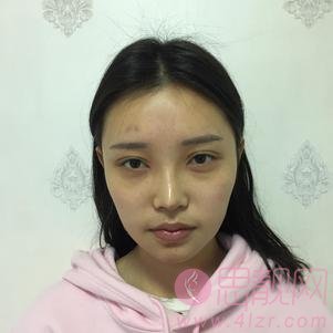 成都军建整形美容医院帅宗国医生怎么样？附自体脂肪填充案例及医院价格表