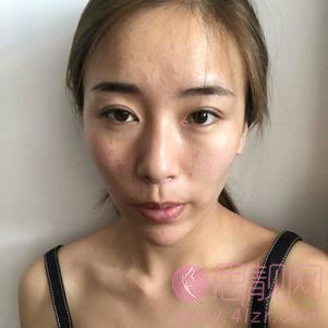 北京佰嘉利医疗美容医院怎么样？附医院价格表