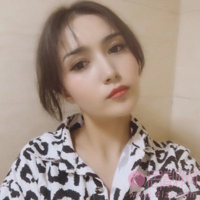扬州施尔美整形美容医院,吴培海医生技术怎么样，附简介及双眼皮案例