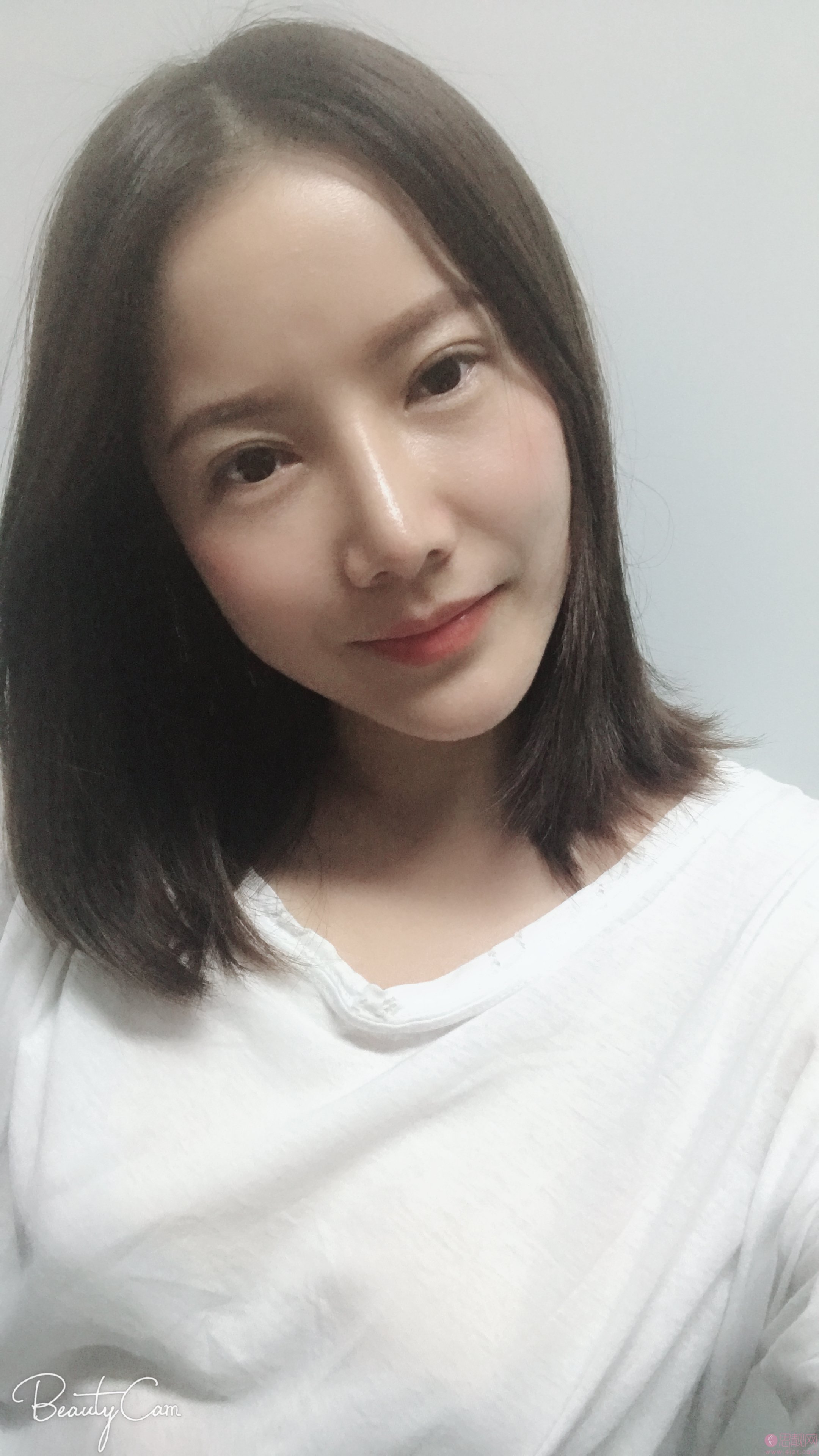 南京医科大学友谊整形外科医院怎么样？附医院价格表及双眼皮案例