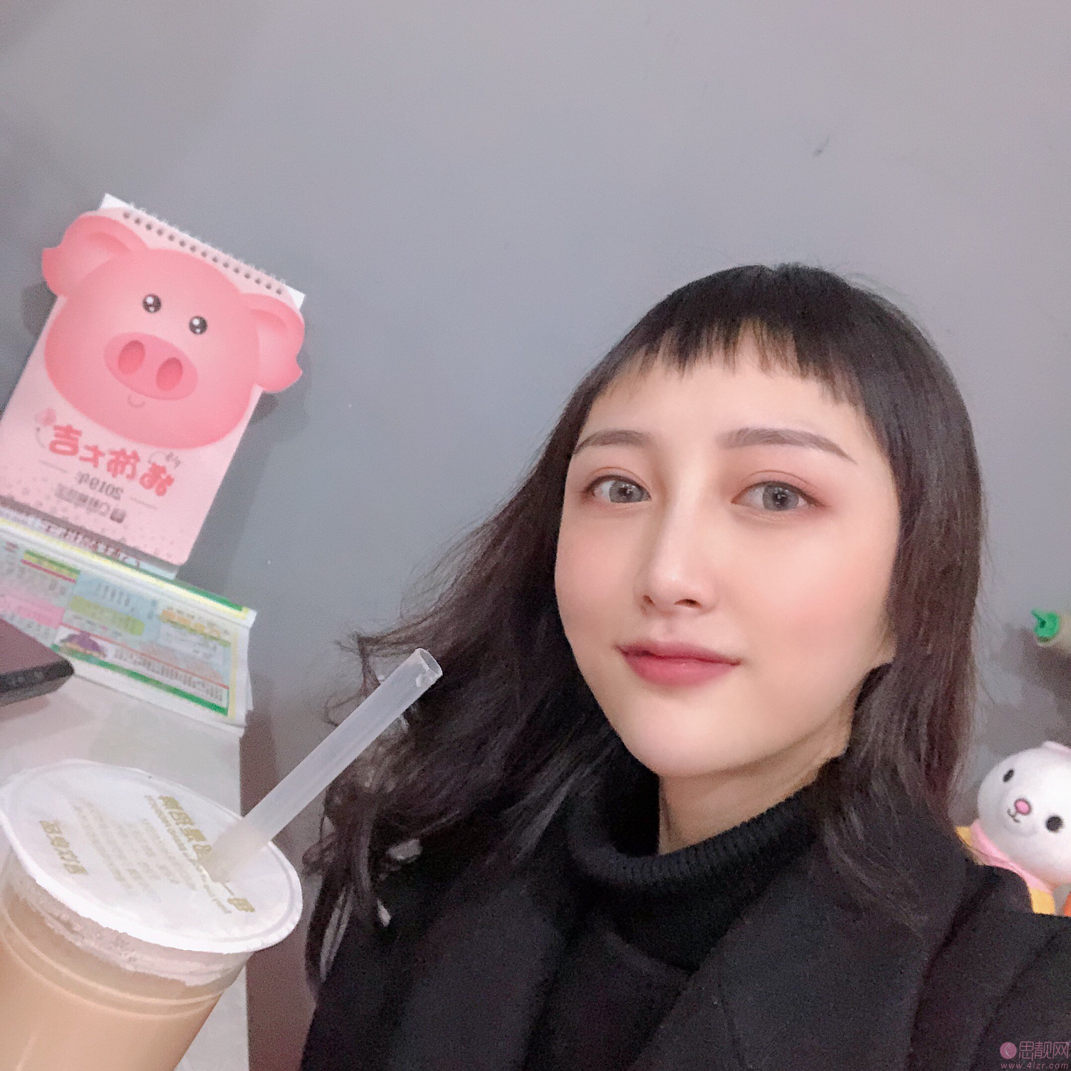 重庆星宸整形美容医院做自体脂肪填充全脸怎么样？附填充真人案例及医院价格表