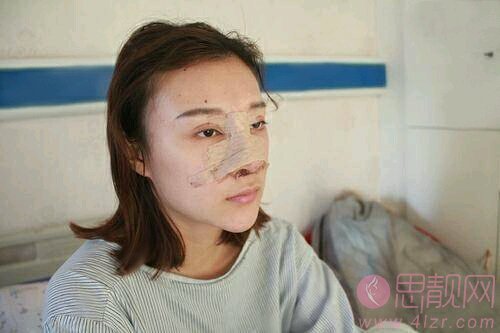 怀化华美医疗美容医院做鼻子怎么样？附隆鼻案例及医院价格表