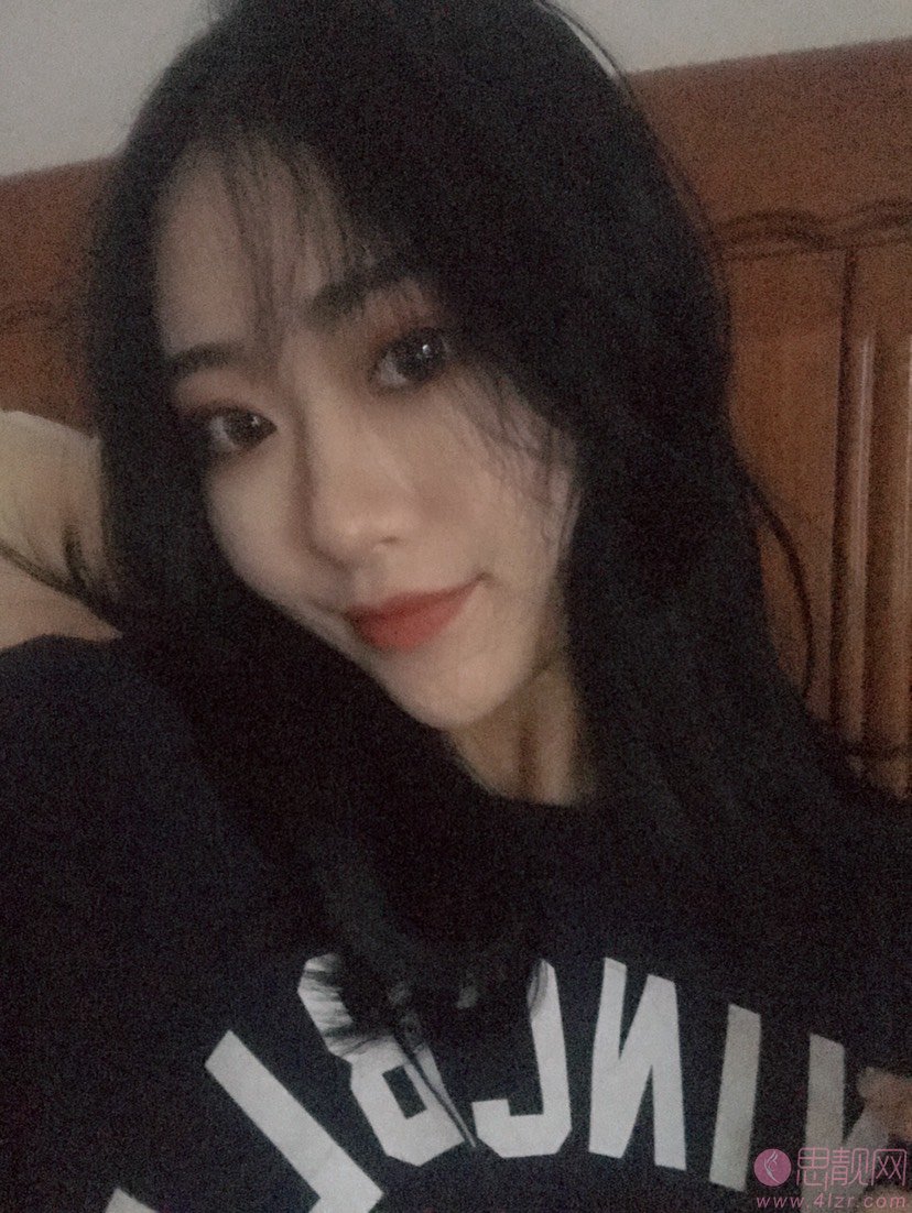 南昌莱美美容医院价格表，附余攀隆鼻案例一览