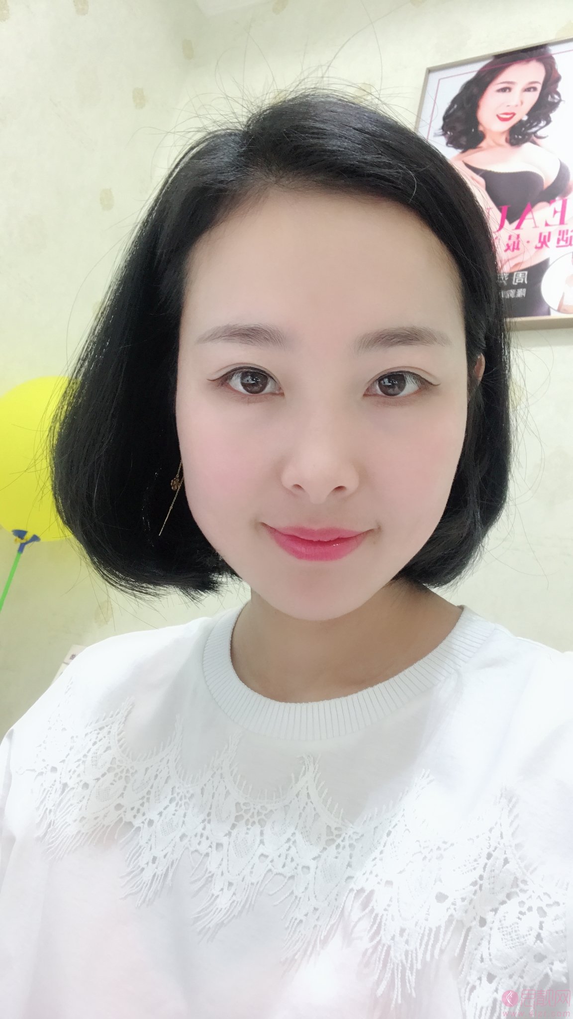 沈阳百嘉丽医疗美容医院价格表，及全切双眼皮效果一览