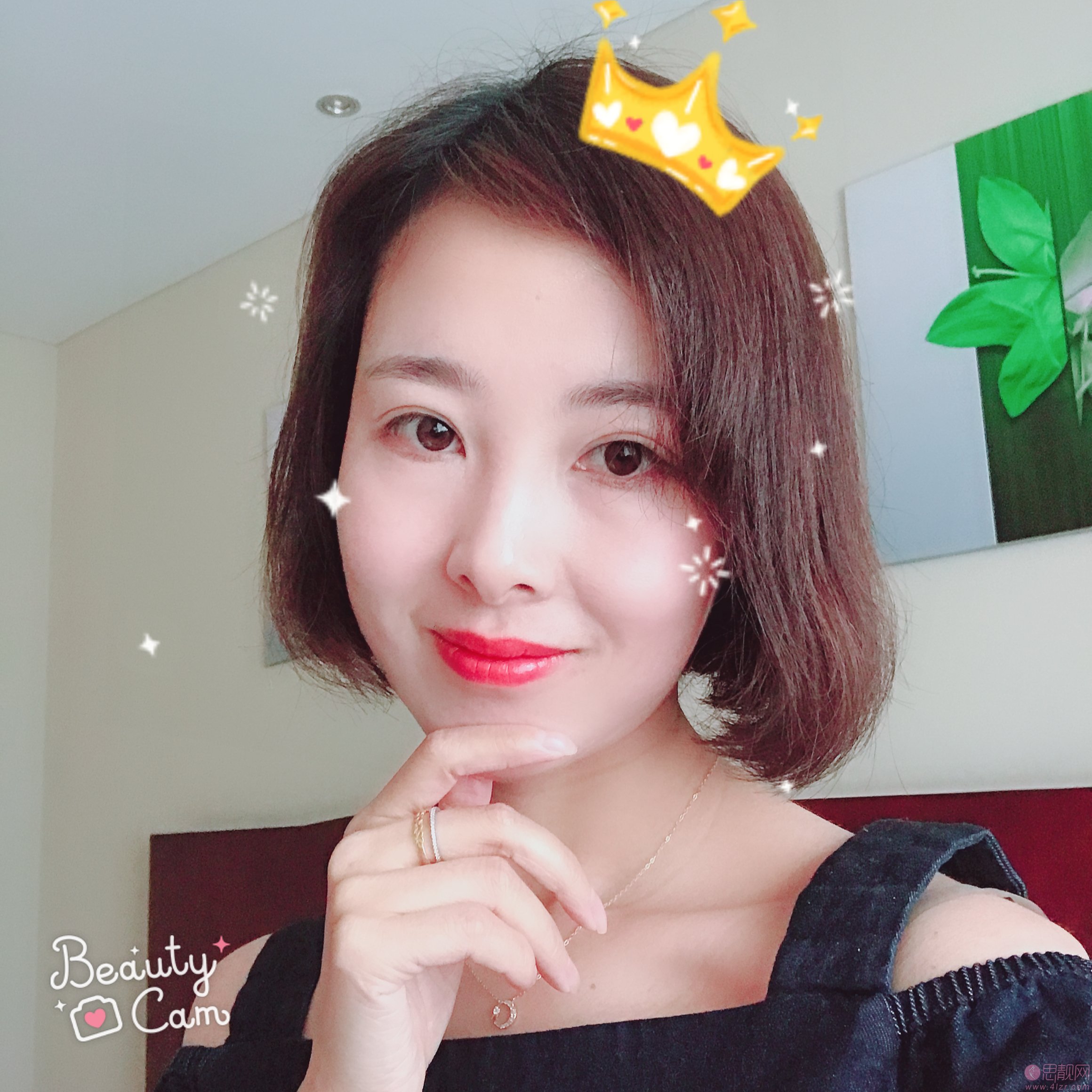 沈阳百嘉丽医疗美容医院价格表，及全切双眼皮效果一览