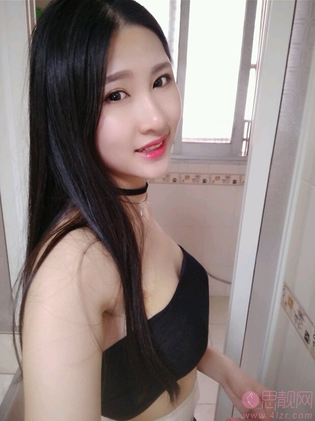 广州军美整形王世虎做隆胸怎么样？附隆胸前后对比效果一览