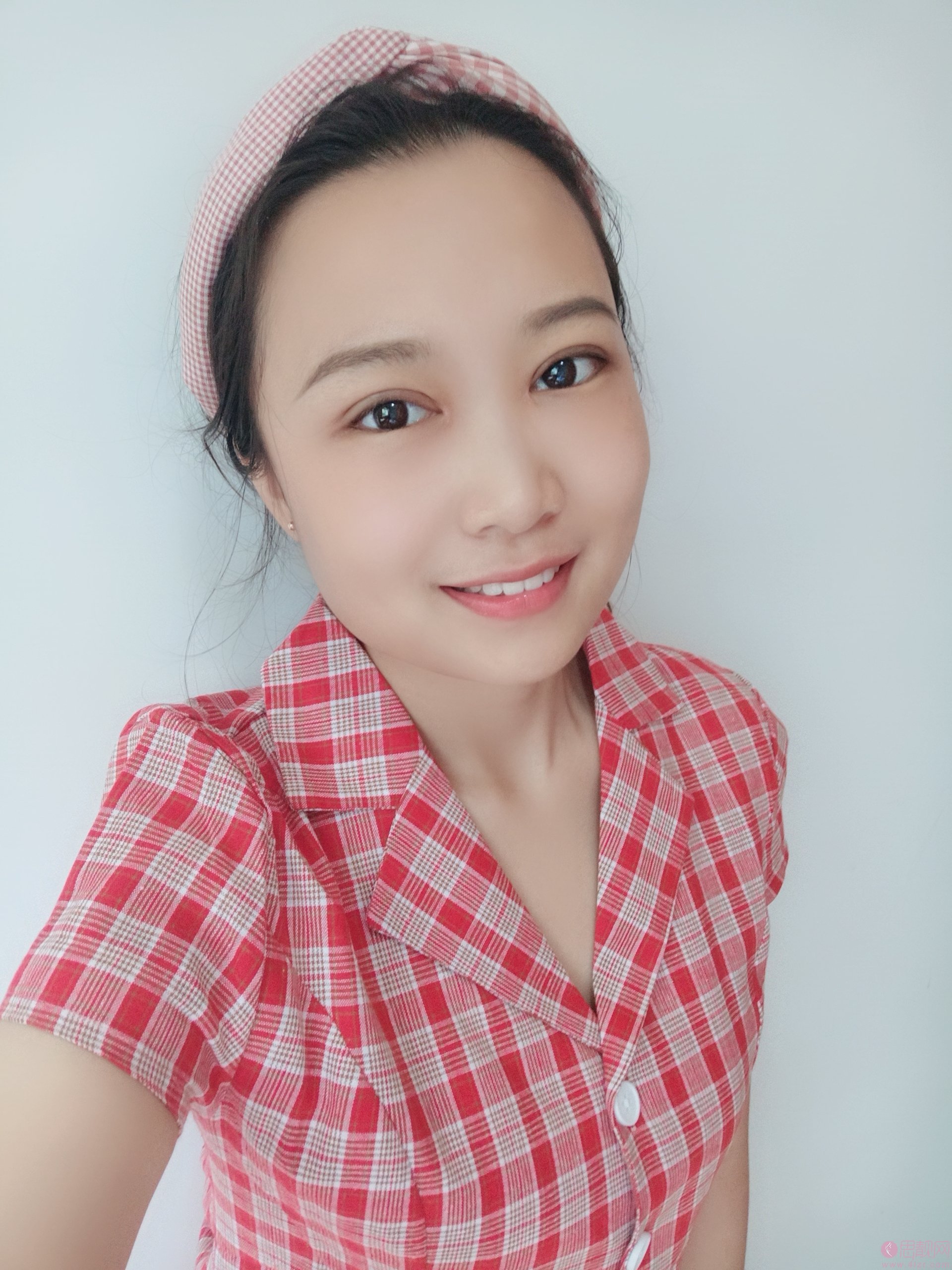 淄博美联臣美容整形医院路卫国医生靠谱吗？附双眼皮案例一览