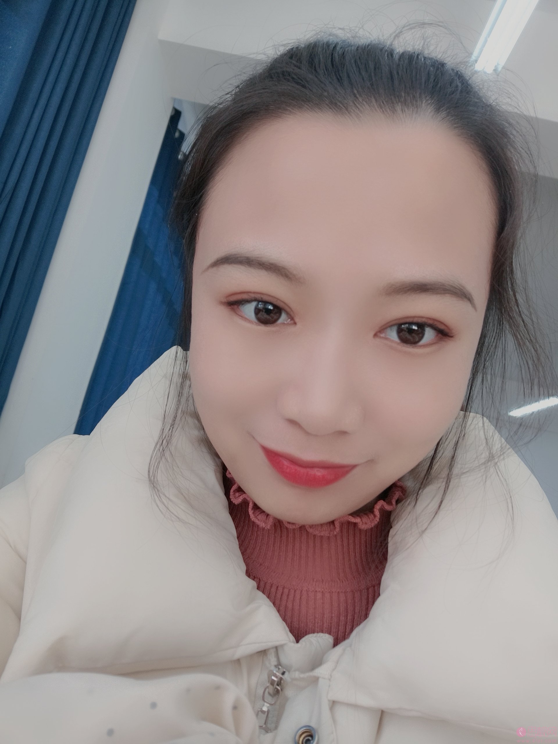 淄博美联臣美容整形医院路卫国医生靠谱吗？附双眼皮案例一览