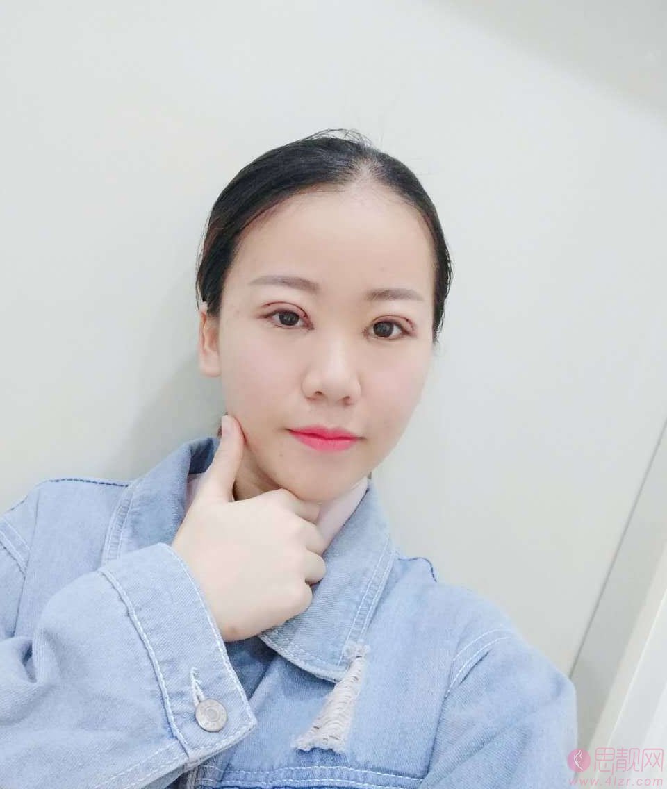 合肥西美整形医院价格表，附张志龙医生简介及双眼皮案例一览