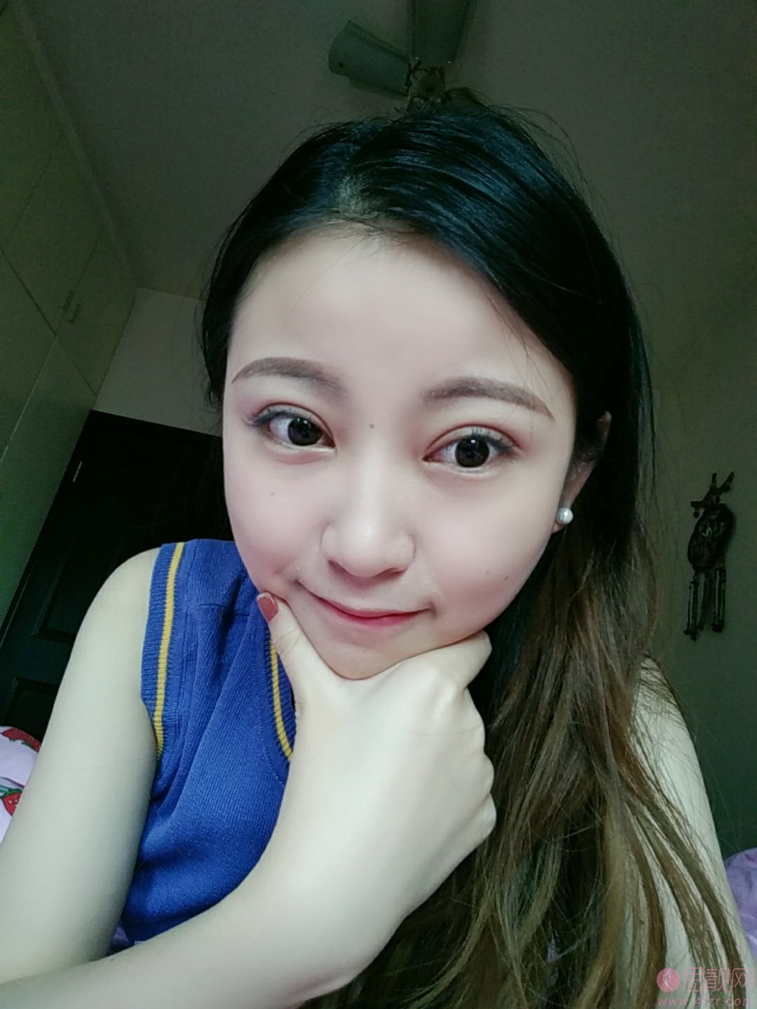 深圳军科医疗美容门诊部刘月更医生做双眼皮怎么样？附双眼皮真人案例一览
