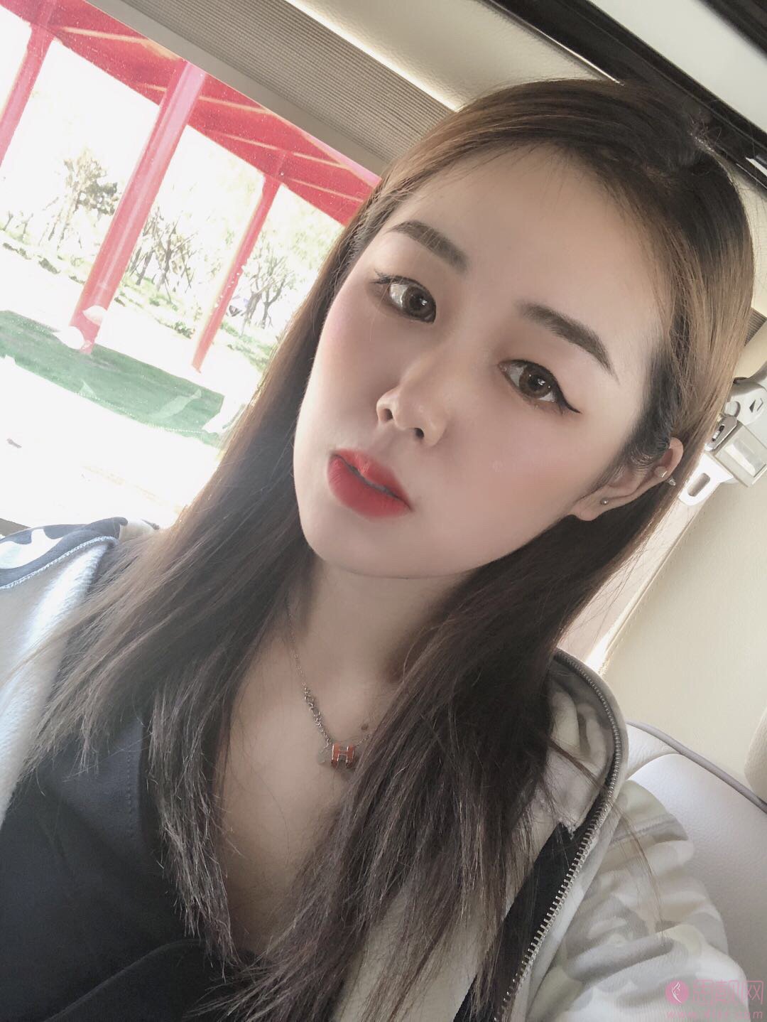 广州伊丽莎白医疗美容医院做双眼皮怎么样？附双眼皮案例及价格表