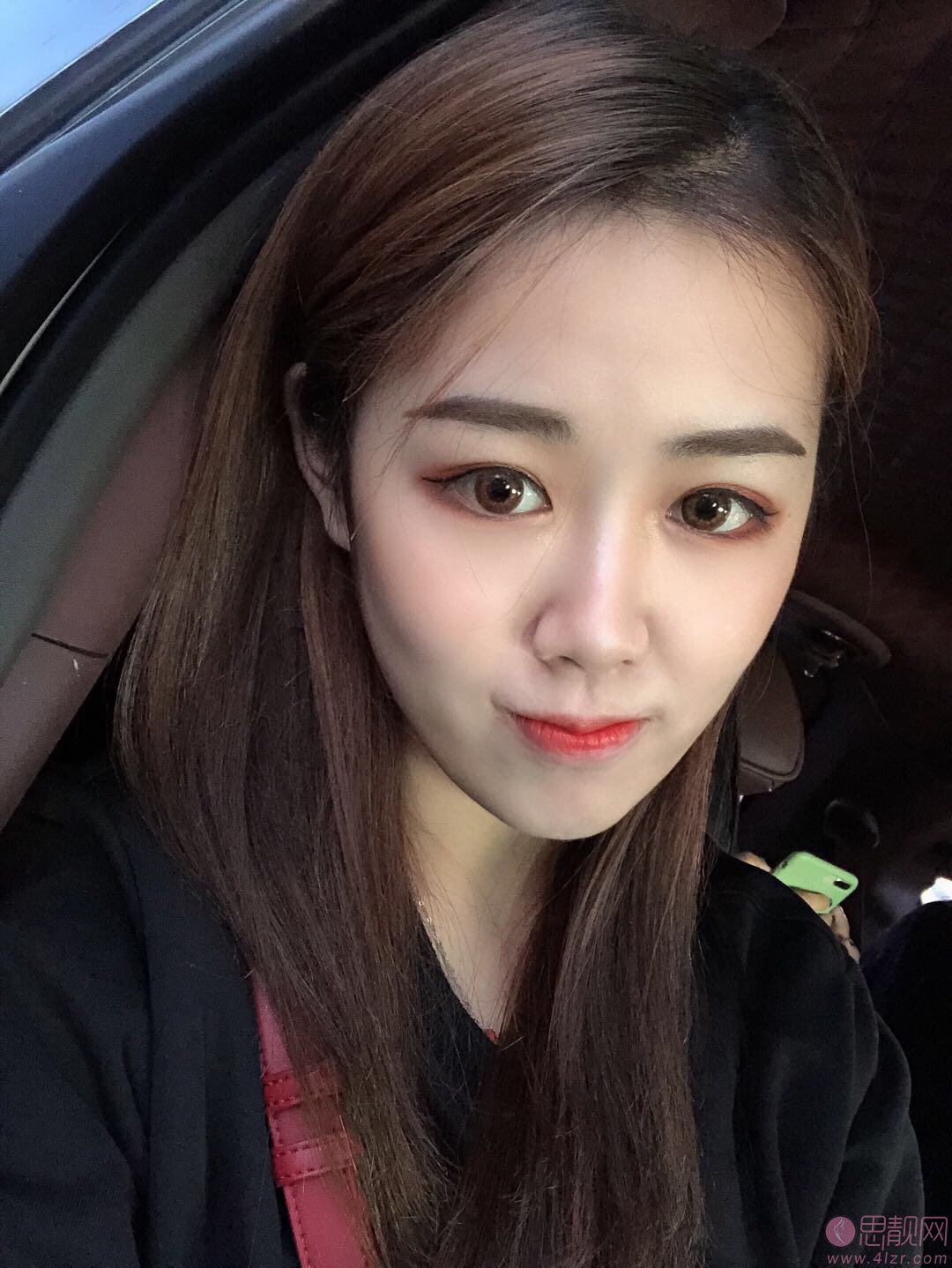 广州伊丽莎白医疗美容医院做双眼皮怎么样？附双眼皮案例及价格表