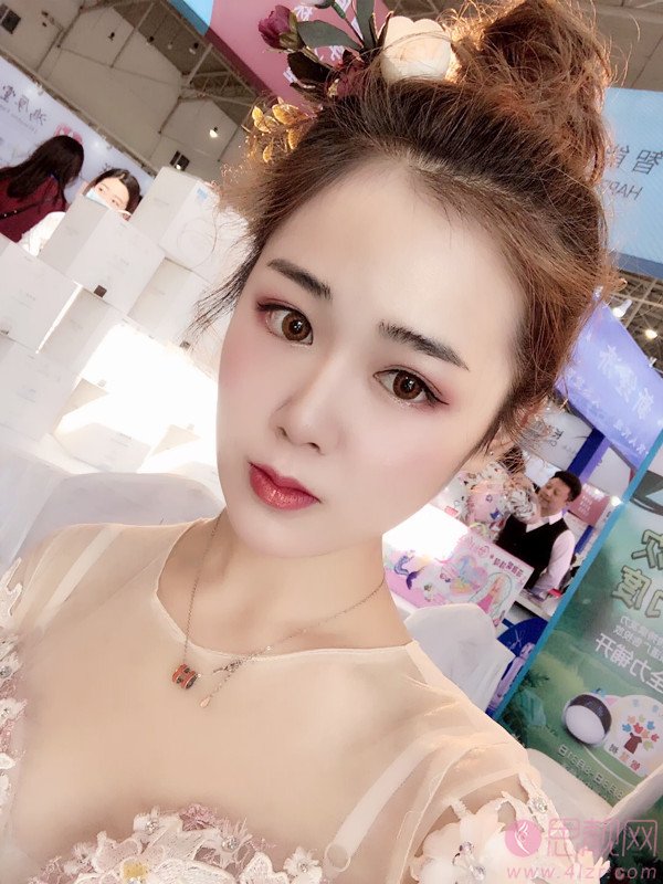 广州伊丽莎白医疗美容医院做双眼皮怎么样？附双眼皮案例及价格表