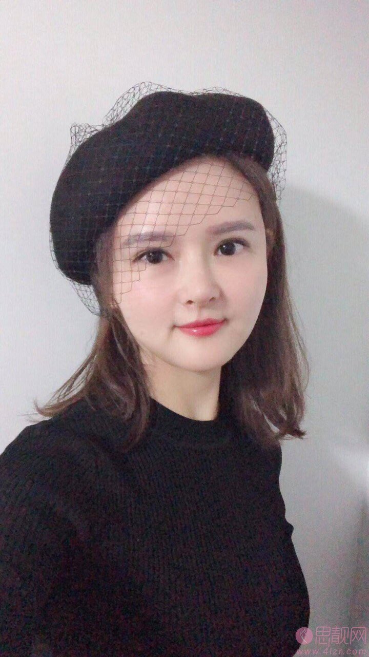 心悦容医疗美容门诊部倪云志隆鼻好不好？附隆鼻真人案例一览及价格表