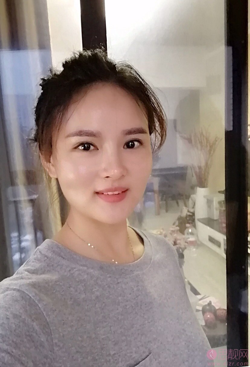 心悦容医疗美容门诊部倪云志隆鼻好不好？附隆鼻真人案例一览及价格表