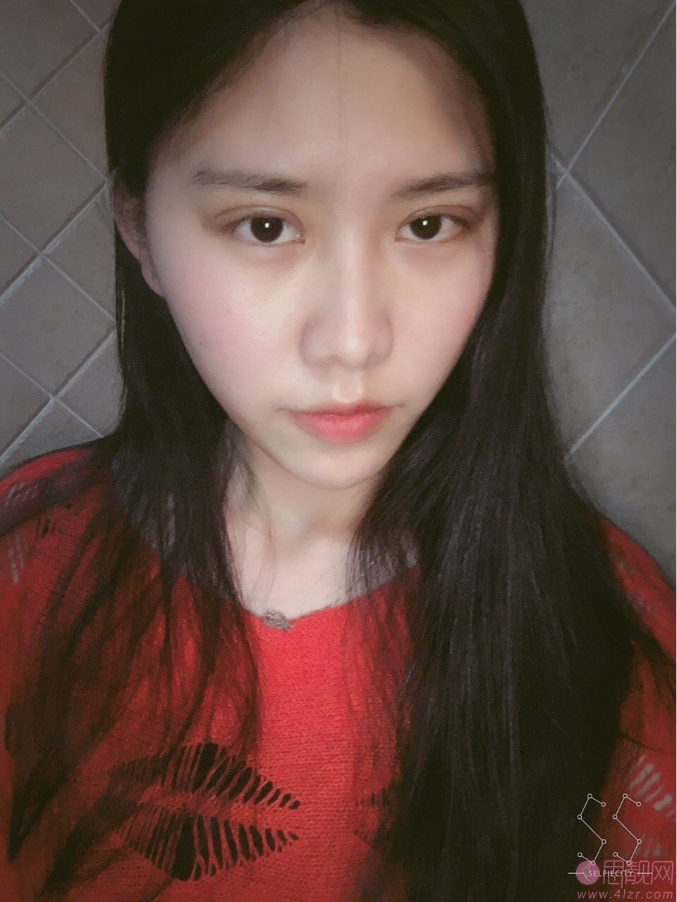 常州曙光医疗美容医院徐怀河怎么样？附双眼皮案例一览