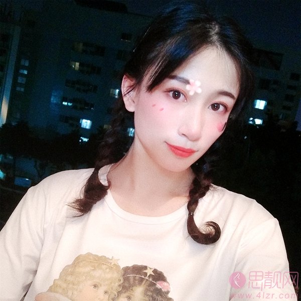 太原丽都植发怎么样？附植发案例一览