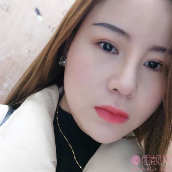 长沙贝美医疗美容熊宜文做隆鼻怎么样？附隆鼻真人案例分享及医院价格表查询