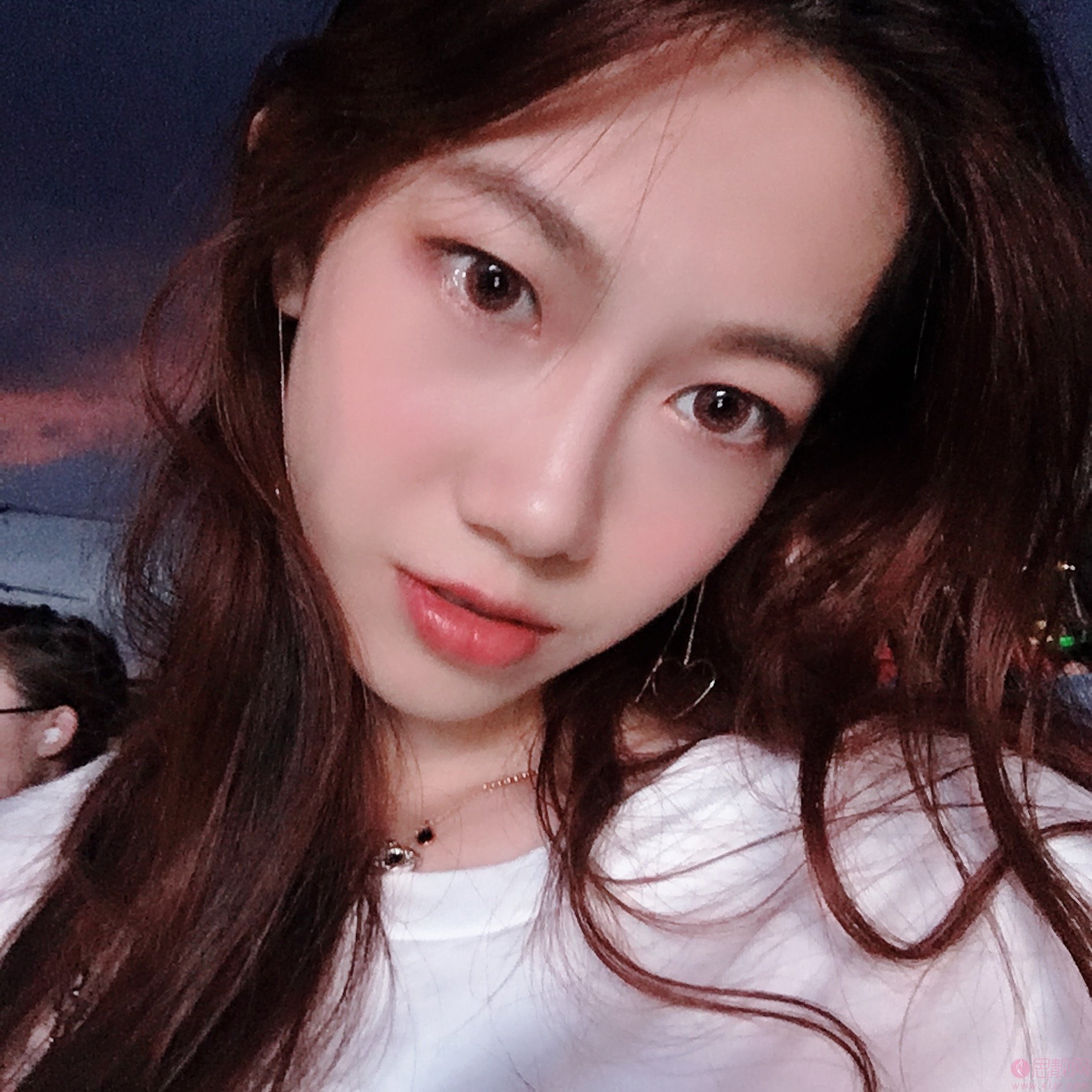 西安画美团圆口腔·牙齿矫正美容中心怎么样？附牙齿矫正案例一览