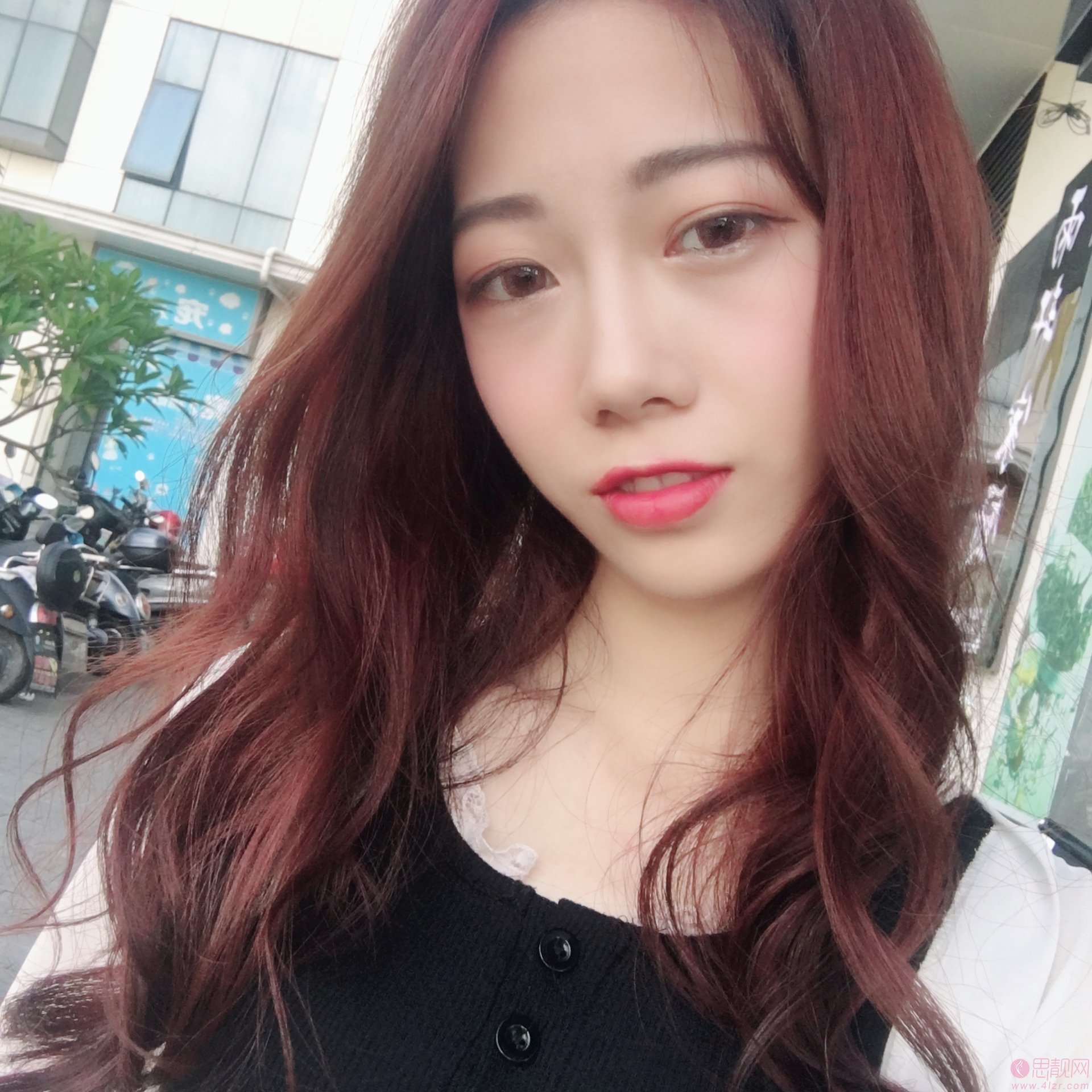 西安画美团圆口腔·牙齿矫正美容中心怎么样？附牙齿矫正案例一览