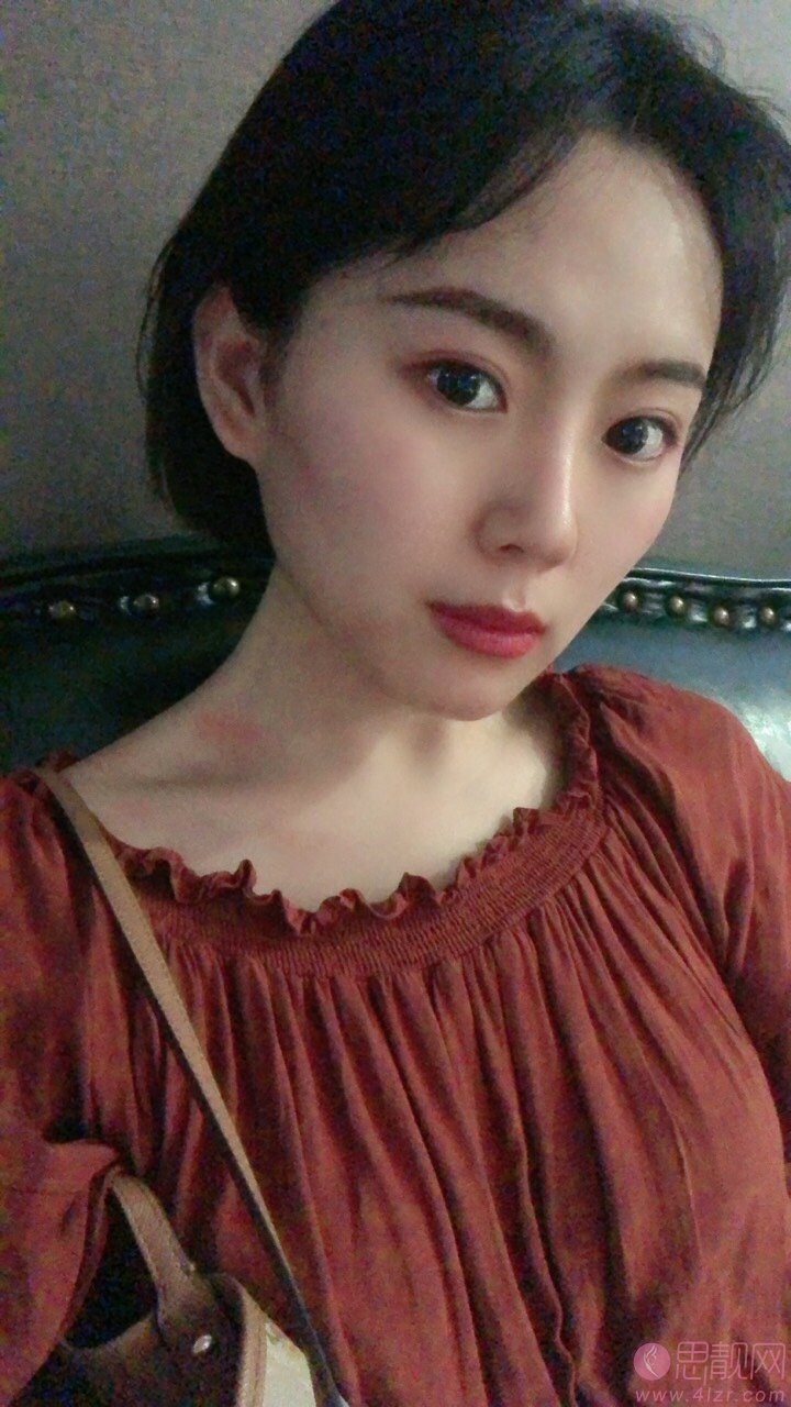 哈尔滨索菲医疗美容陈富全做鼻子怎么样？附隆鼻案例一览