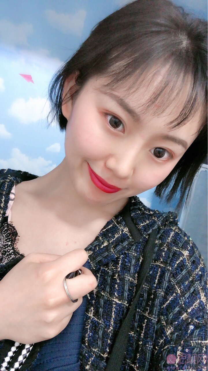 哈尔滨索菲医疗美容陈富全做鼻子怎么样？度隆鼻案例一览