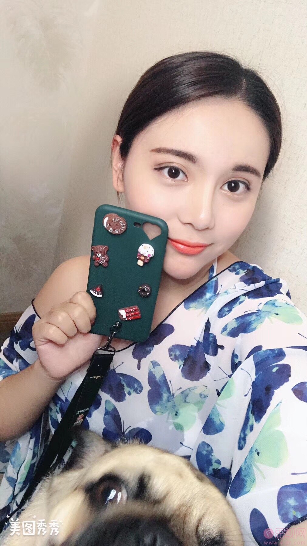青岛壹美天成整形美容医院杨宁双眼皮效果展示，附价格表