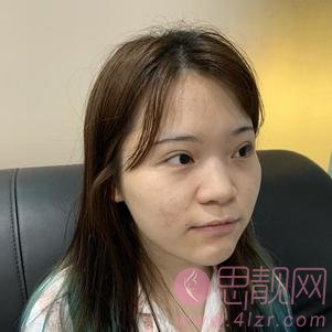成都素美卢元刚做鼻子怎么样，附隆鼻案例及价格表