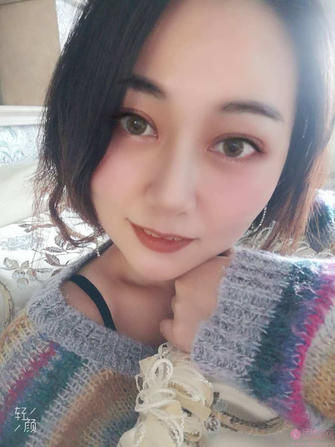 八大处陈江庭做双眼皮怎么样？附双眼皮案例一览
