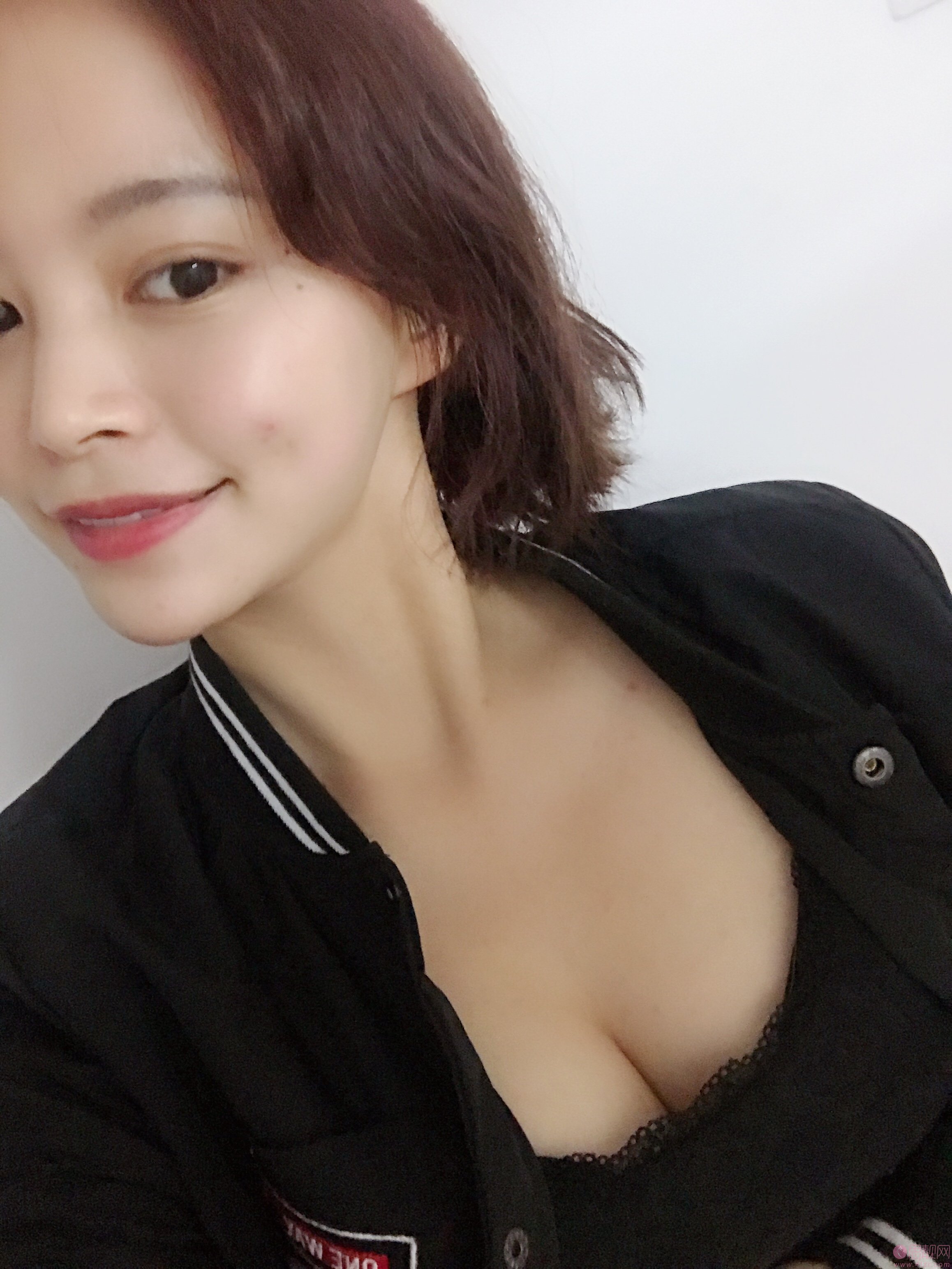 成都美上美罗通贵做假体隆胸怎么样？附价格表及隆胸效果案例展示