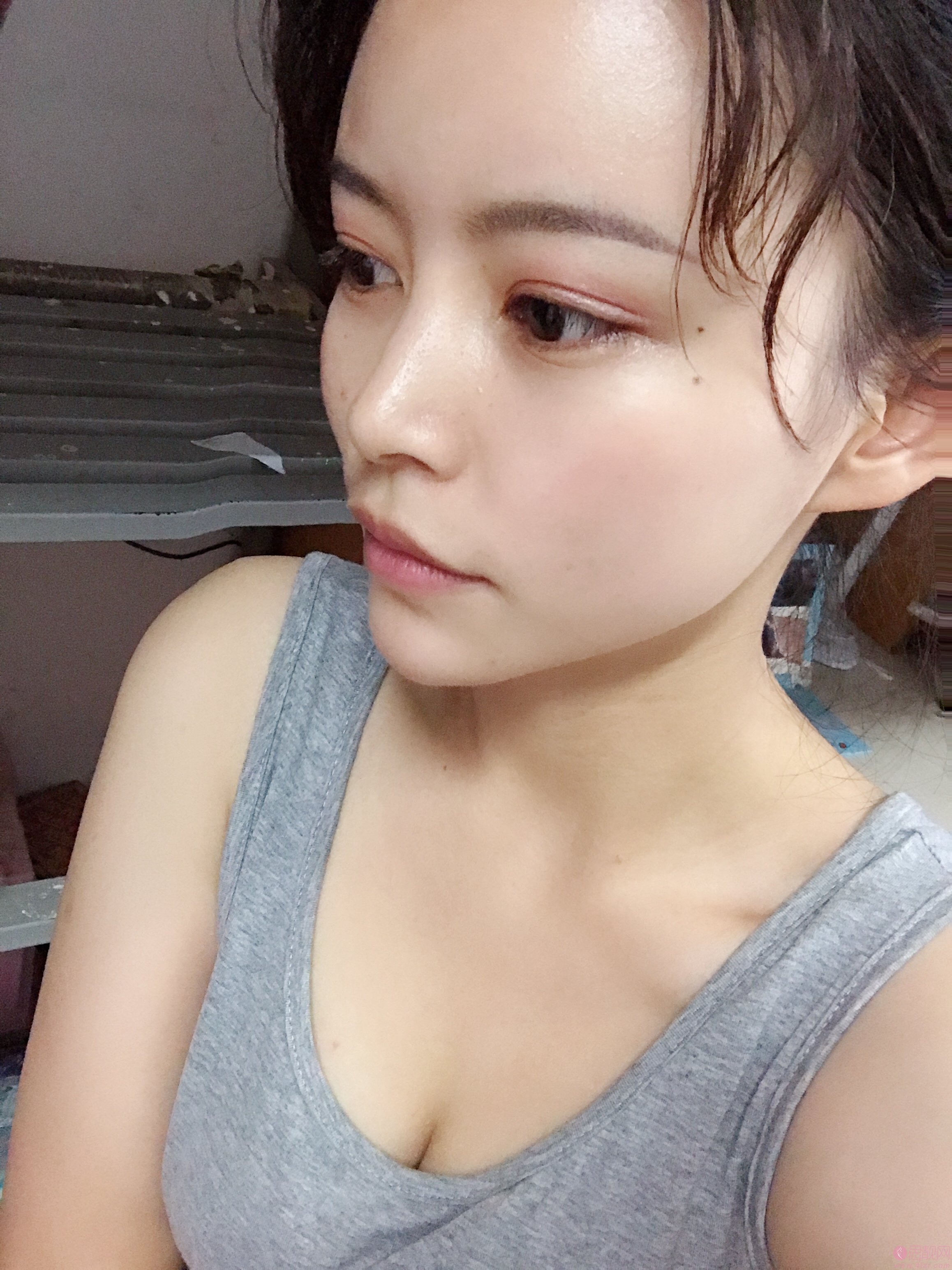 成都美上美罗通贵做假体隆胸怎么样？附价格表及隆胸效果案例展示