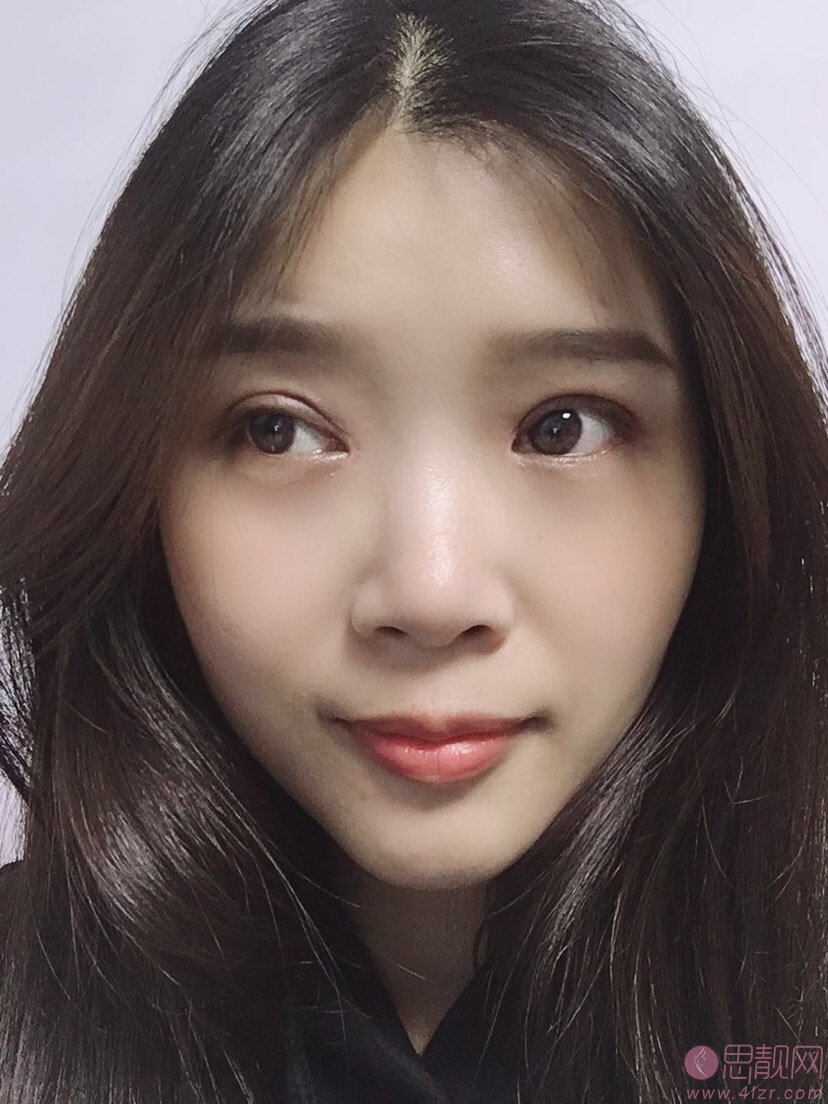 北京韩勋眼修复