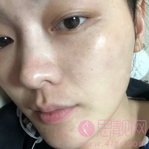 大连维恩医疗美容水光针怎么样，附价格表表一览