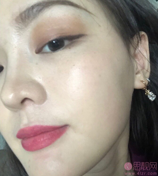 大连维恩医疗美容水光针怎么样，附价格表表一览